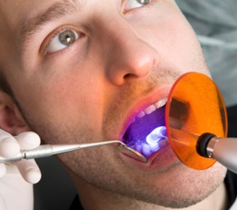 Trám răng có đau không?