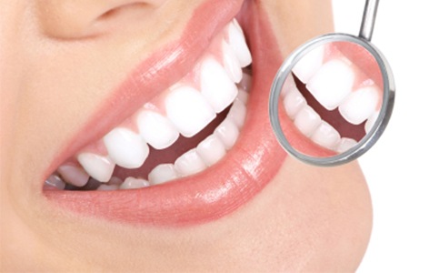 Một số trường hợp làm răng sứ - tẩy trắng răng tại Nha Khoa Ngọc Nha